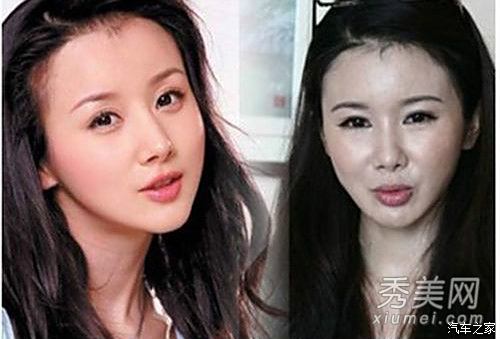 整形明星前后對比，揭秘美麗背后的故事，揭秘整形明星前后對比，美麗背后的故事探秘