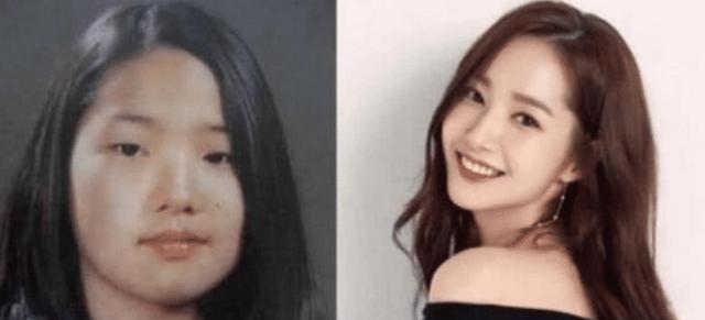整容最成功的女星，背后的故事與啟示，整容成功女星的背后故事與啟示