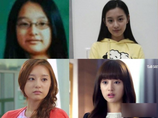 韓國女星整容，探索背后的故事與真相，韓國女星整容背后的故事與真相探索
