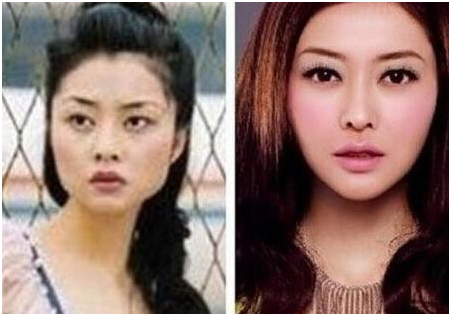 整容最成功的人，探索美麗變革的藝術(shù)，探索美麗變革的藝術(shù)，整容最成功的人的故事