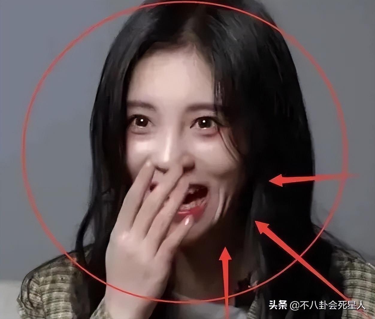 蔡徐坤有沒有整容呀