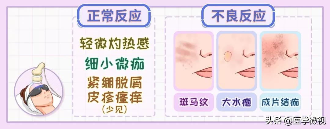 光子嫩膚后14天出現(xiàn)滿臉黑斑，該如何應對？，光子嫩膚后黑斑問題，應對策略與建議