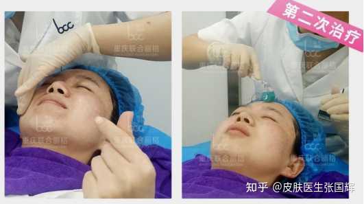 醫(yī)院做一次光子嫩膚的價格是多少？全面解析給您聽，醫(yī)院光子嫩膚價格全解析，一次治療究竟需要多少錢？