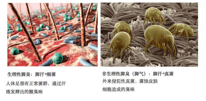如何判斷是否是腳氣，癥狀、原因及應(yīng)對(duì)方法，腳氣判斷指南，癥狀、原因與應(yīng)對(duì)方法全解析