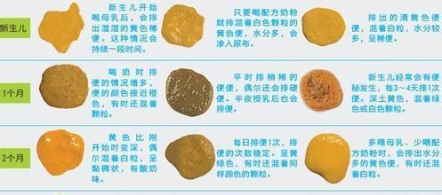 嬰兒消化不良的大便圖，識(shí)別、原因及處理方法，嬰兒消化不良大便解析，識(shí)別、原因與處理方法