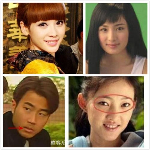 女明星整容，現(xiàn)象背后的深度解析，女明星整容現(xiàn)象背后的深度解析與探討