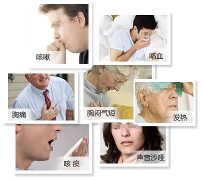 肺部結(jié)節(jié)最怕的三個征兆，肺部結(jié)節(jié)需警惕的三個征兆