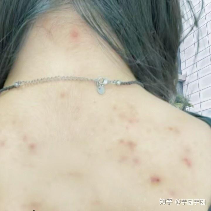診斷與處理方法