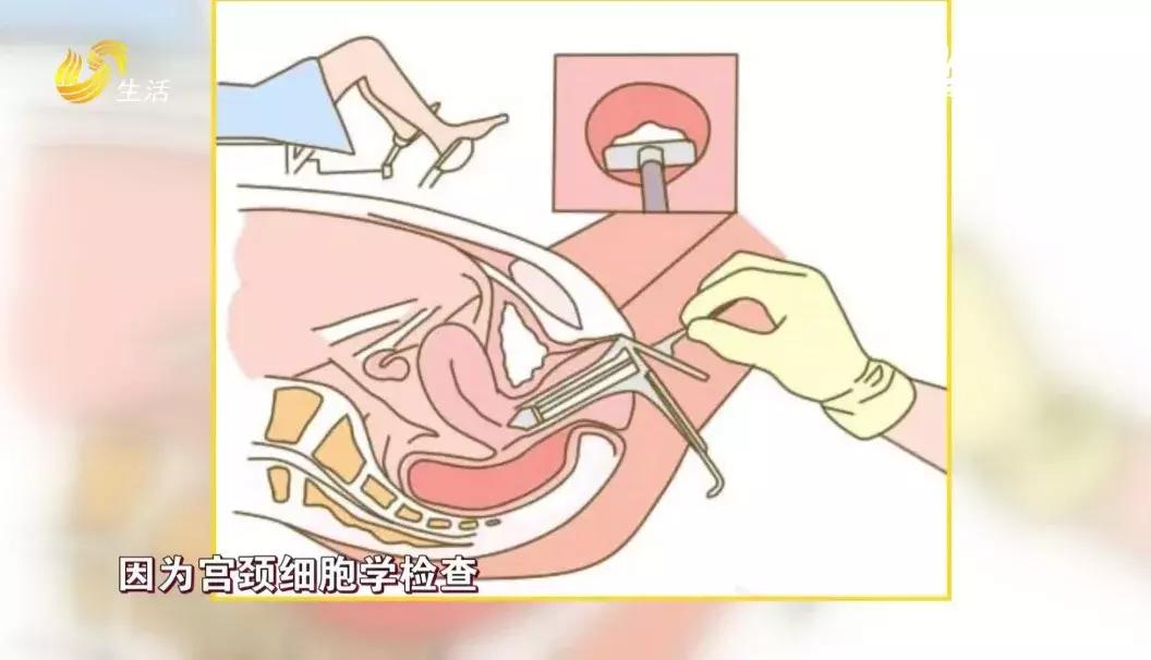 宮頸活檢后的心理調(diào)適與積極面對——一位女性的真實(shí)經(jīng)歷，宮頸活檢后的心理調(diào)適與積極面對，一位女性的心靈之旅