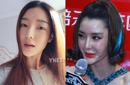 整容失敗的案例，教訓(xùn)與反思，整容失敗案例，教訓(xùn)、反思與警示