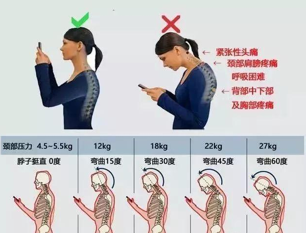 頸椎病三個動作自愈方法——自然緩解頸椎疼痛的途徑，頸椎病自然康復法，三個動作助您擺脫頸椎疼痛