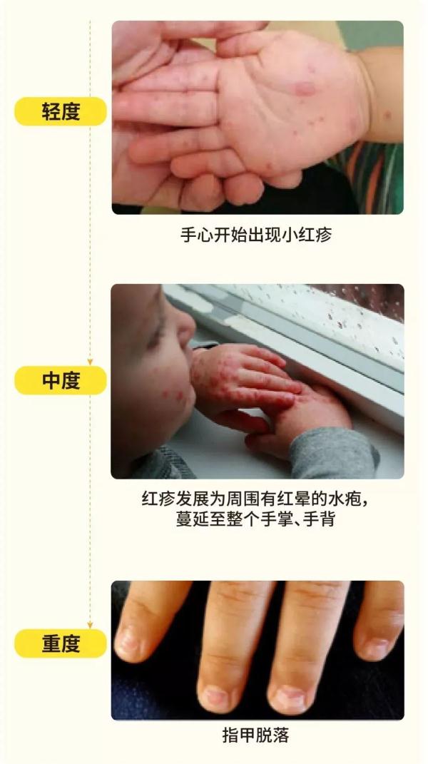 識別指南