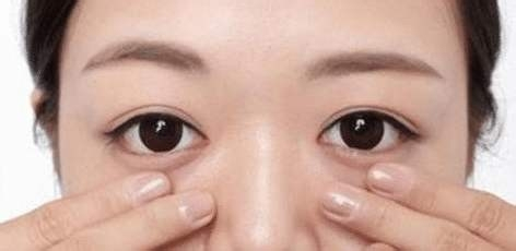 去除眼袋的最快方法，快速去除眼袋的方法