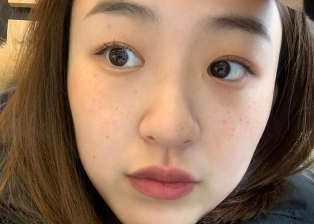 斑怎么才能慢慢淡化，全面解析祛斑方法與技巧，全面解析，如何有效淡化斑點，祛斑方法與技巧大揭秘