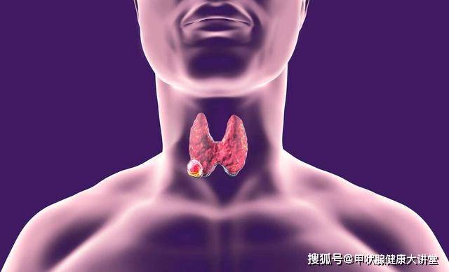 甲狀腺結(jié)節(jié)大小多少mm以上應(yīng)考慮手術(shù)治療？，甲狀腺結(jié)節(jié)大小與手術(shù)治療考量，超過多少mm需手術(shù)？