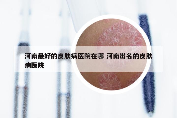 尋找中國最擅長治療皮膚病的醫(yī)院，專業(yè)實(shí)力與信譽(yù)的雙重考量，尋找中國皮膚病治療領(lǐng)域的佼佼者，專業(yè)實(shí)力與信譽(yù)的雙重考量