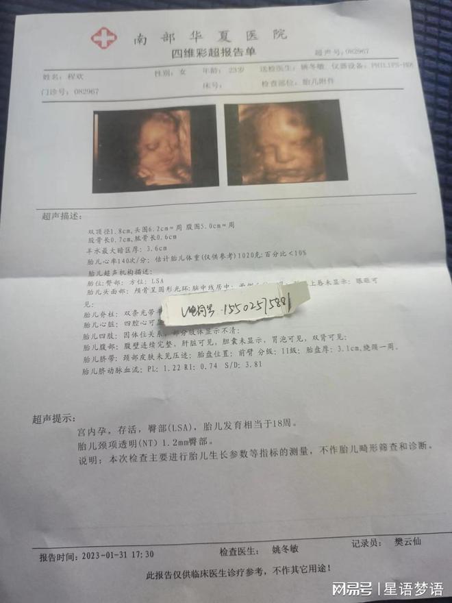 關于排卵流出來的正常圖片，深入了解女性生理周期的重要一環(huán)，女性生理周期揭秘，排卵流出圖片解析，洞悉排卵過程的重要性