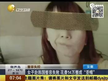 整容成功率有多高，全面解析與深度探討，整容成功率深度解析與探討，全面揭示成功率及影響因素