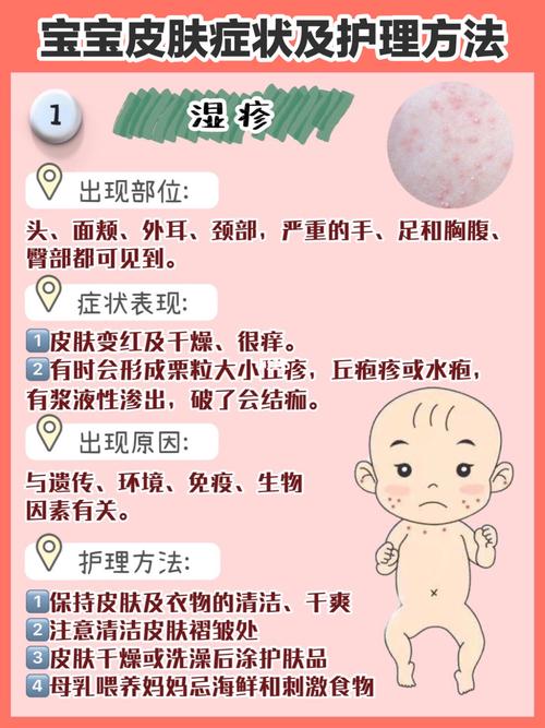 嬰兒濕疹怎么處理最好辦法，嬰兒濕疹的最佳處理方法