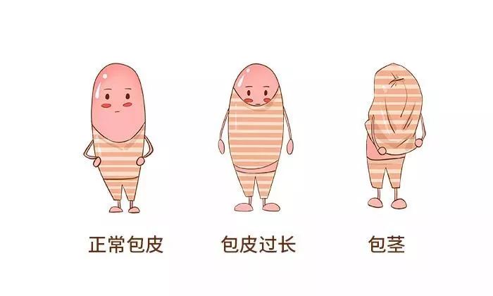 男人割皮的好處和壞處，全面解析與理解，男性割皮手術(shù)，好處與壞處的全面解析與理解