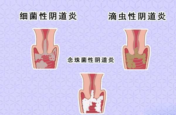 陰外面毛毛癢的原因及應(yīng)對(duì)方法，陰外面毛毛癢的原因與應(yīng)對(duì)方法解析
