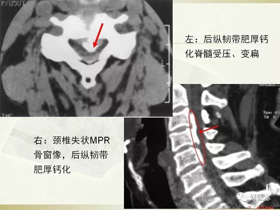如何判斷精囊已滿，全面解讀男性健康知識(shí)，男性健康知識(shí)全面解讀，如何判斷精囊已滿？