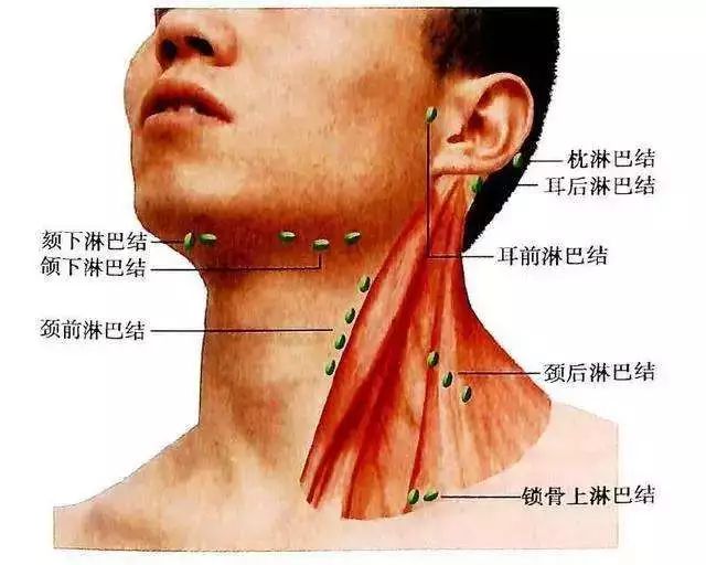 十個(gè)人九個(gè)有淋巴結(jié)腫大，原因、診斷與治療方法，淋巴結(jié)腫大，普遍原因、診斷及治療方法