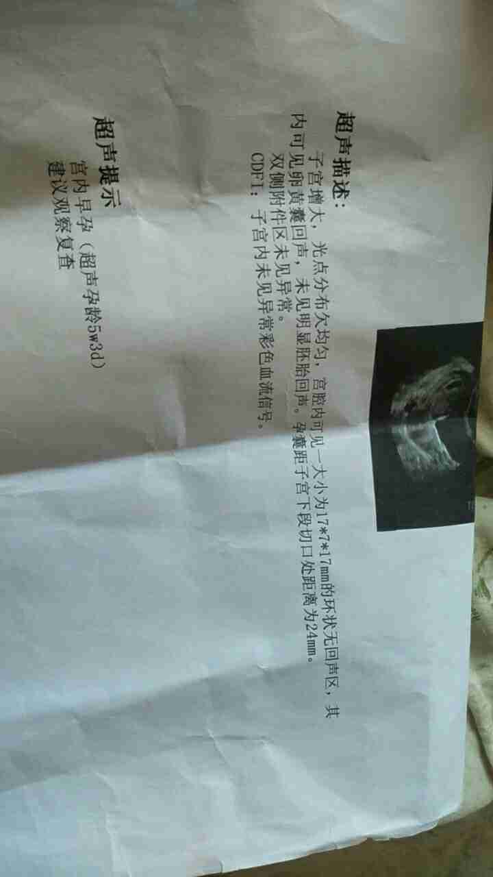 無痛人流需要多少錢？一篇文章全面解析費用構(gòu)成，全面解析無痛人流費用構(gòu)成，手術(shù)費用及注意事項一網(wǎng)打盡！