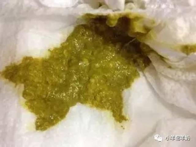 十種寶寶大便分辨圖及其重要性，寶寶大便分辨圖詳解，十種類型及其重要性解析