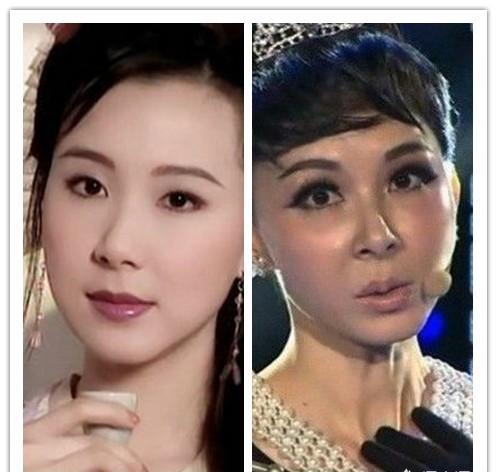 明星都去哪里整容，揭秘背后的秘密，揭秘明星整容背后的秘密，他們究竟去了哪些神秘之地？