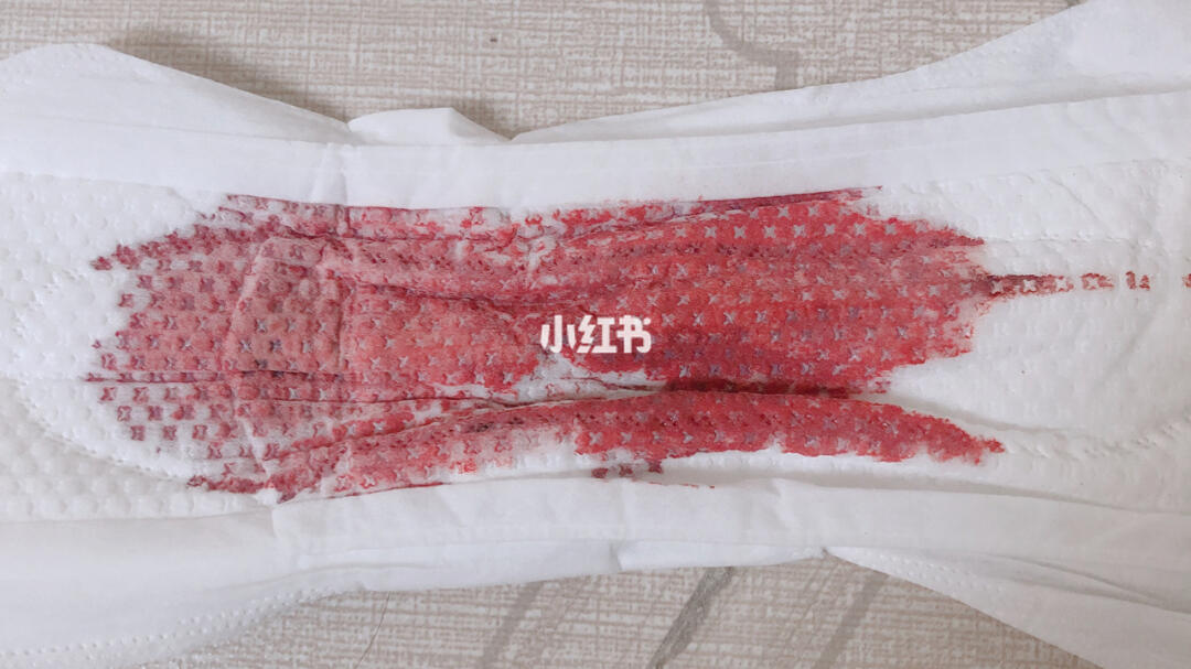 月經(jīng)遲遲不走，一擦就有血——原因解析與應(yīng)對(duì)措施，月經(jīng)持續(xù)不止，原因解析及應(yīng)對(duì)方法