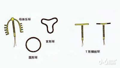 女性上環(huán)的危害和副作用解析，女性上環(huán)的危害與副作用詳解