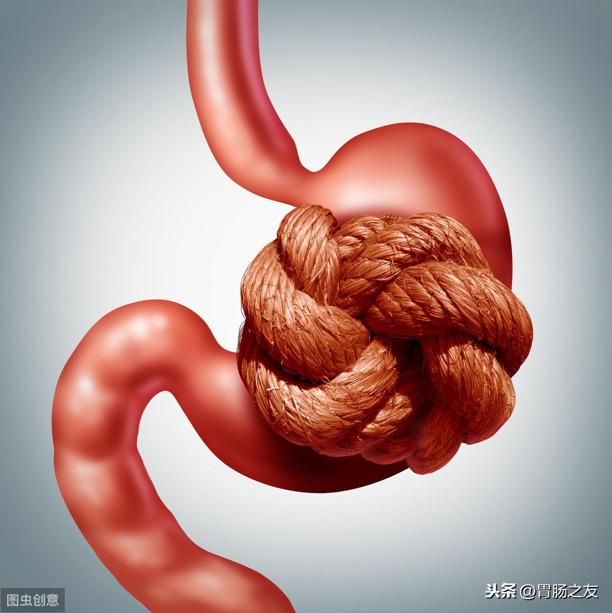 胃炎必吃三種藥，理解治療與預(yù)防的關(guān)鍵，胃炎治療必備三種藥物，理解關(guān)鍵的治療與預(yù)防措施之道