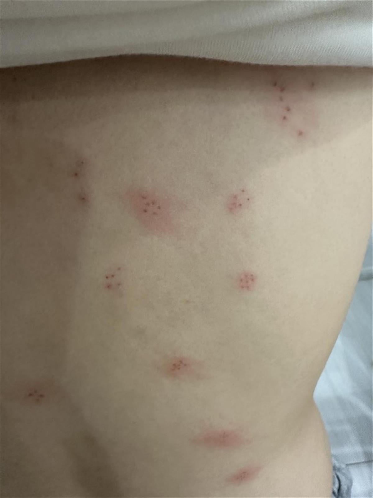 女士尖銳濕疣生長位置解析，了解病癥，關注健康，女士尖銳濕疣生長位置詳解，關注病癥，守護女性健康