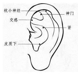 解決失眠的最佳方法，解決失眠的有效方法或技巧