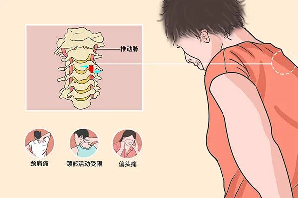 如何判斷自己是否患有頸椎病，如何判斷自身是否患有頸椎病？