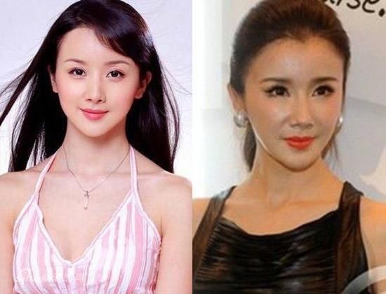 整容過(guò)的女明星都有誰(shuí)，揭秘娛樂(lè)圈的美麗變革，揭秘整容過(guò)的女明星，娛樂(lè)圈的美麗變革之旅