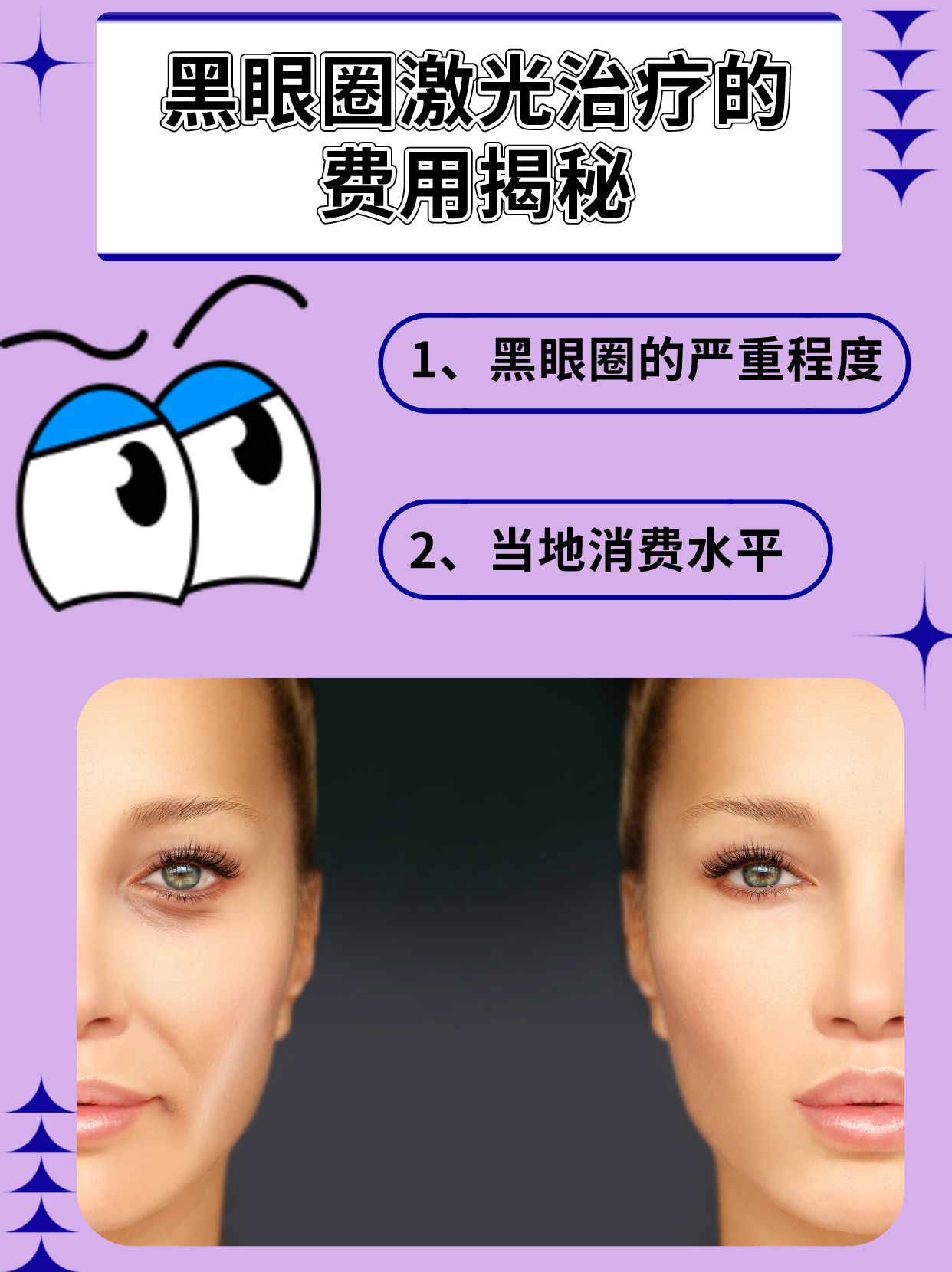 黑眼圈激光一次多少錢，全面解析費(fèi)用因素與注意事項(xiàng)，黑眼圈激光費(fèi)用解析，價格、費(fèi)用因素與注意事項(xiàng)全指南