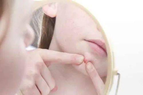 怎樣揉痘痘？從痘痘護理到腿軟舒適的小技巧，痘痘護理全攻略，從按摩痘痘到腿部舒適的小技巧