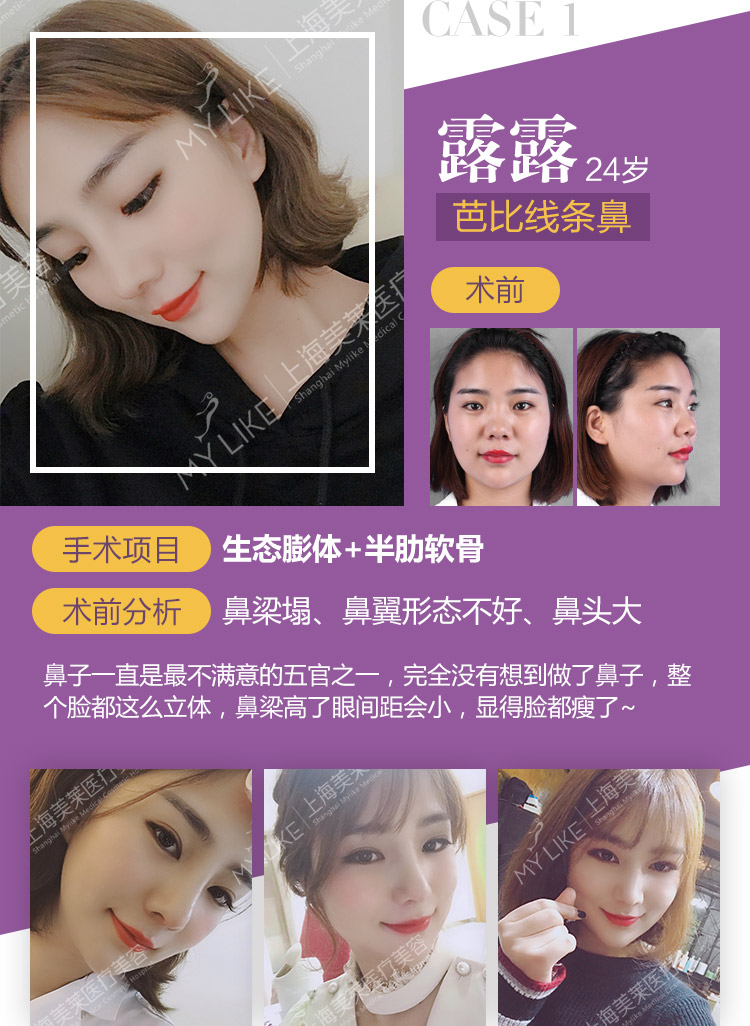哪家隆鼻整容好，專業(yè)機構的選擇與評估指南，專業(yè)機構選擇指南，如何選擇好的隆鼻整容機構
