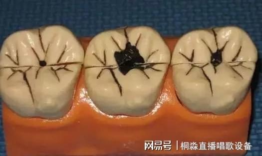 蛀牙疼痛難忍怎么辦？全面解析應(yīng)對(duì)之策，蛀牙疼痛全面應(yīng)對(duì)指南，解析疼痛原因與有效緩解之策