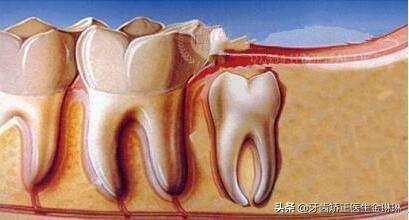 牙科拔牙收費(fèi)價(jià)目表——全面了解拔牙費(fèi)用，牙科拔牙費(fèi)用詳解，拔牙收費(fèi)價(jià)目表全面解析