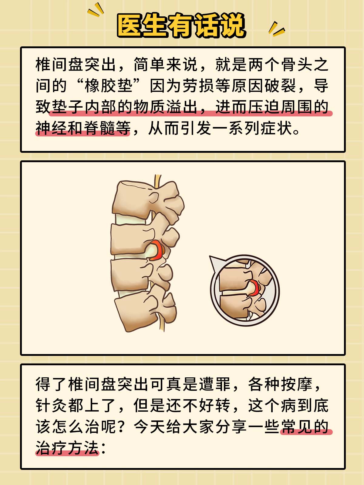 椎間盤突出最佳治方法，椎間盤突出最佳治療方法探索