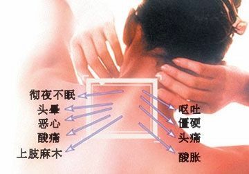 治療頸椎的最佳土方法——自然療法與日常保健，自然療法與日常保健，治療頸椎的最佳土方法之道