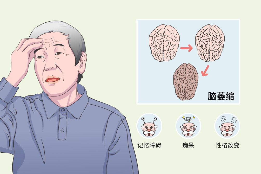 小腦萎縮的征兆，早期識(shí)別與應(yīng)對(duì)，小腦萎縮的征兆，早期識(shí)別與應(yīng)對(duì)策略